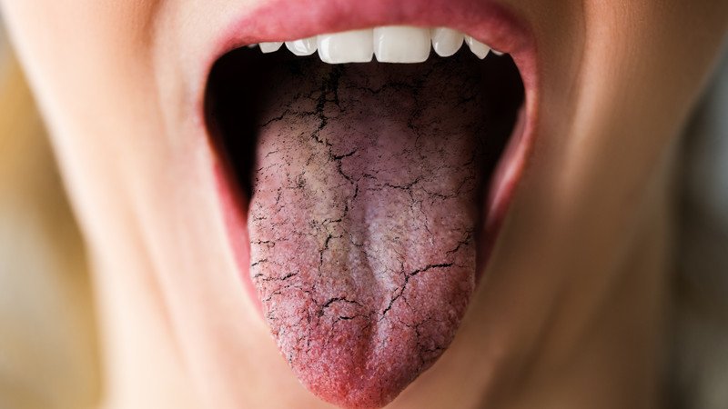 Bác sĩ thăm khám chẩn đoán nấm lưỡi ở người trưởng thành