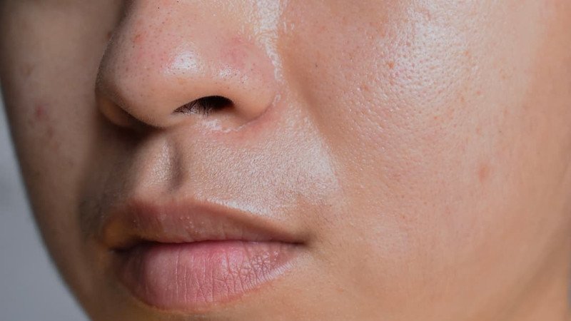 BHA giúp làm sạch sâu lỗ chân lông cho da dầu mụn