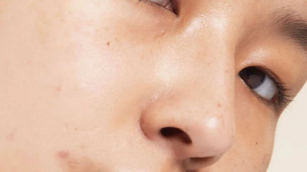 Biểu đồ so sánh vùng da dầu trên mặt, giúp nhận biết da hỗn hợp thiên dầu