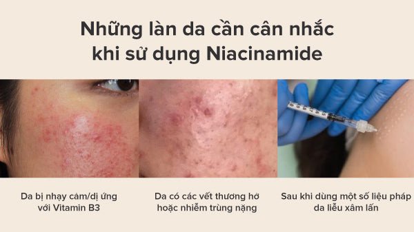 Các trường hợp không nên dùng Niacinamide trên da