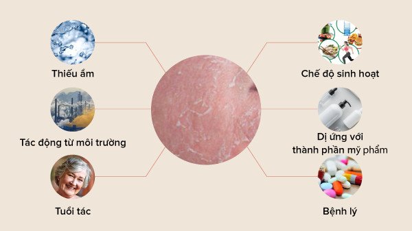 Các yếu tố phổ biến gây ra tình trạng da bị bong tróc và đỏ rát sau khi rửa mặt, cần nhận diện để khắc phục.