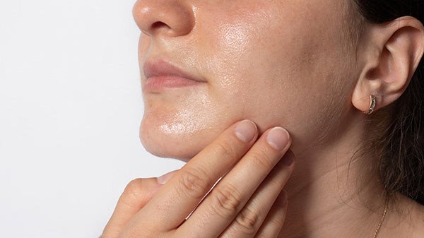 Chăm sóc da hỗn hợp đúng cách