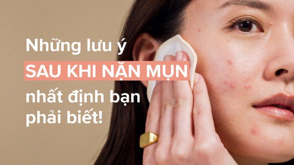 Chăm sóc da sau khi nặn mụn đúng cách để da mau lành và tránh sẹo thâm