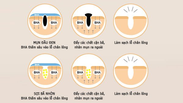 Cơ chế hoạt động sâu của BHA trong lỗ chân lông