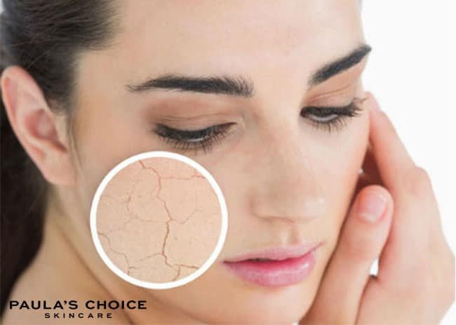 Cơ chế tác động sâu của tẩy tế bào chết hóa học giúp tái tạo da hiệu quả