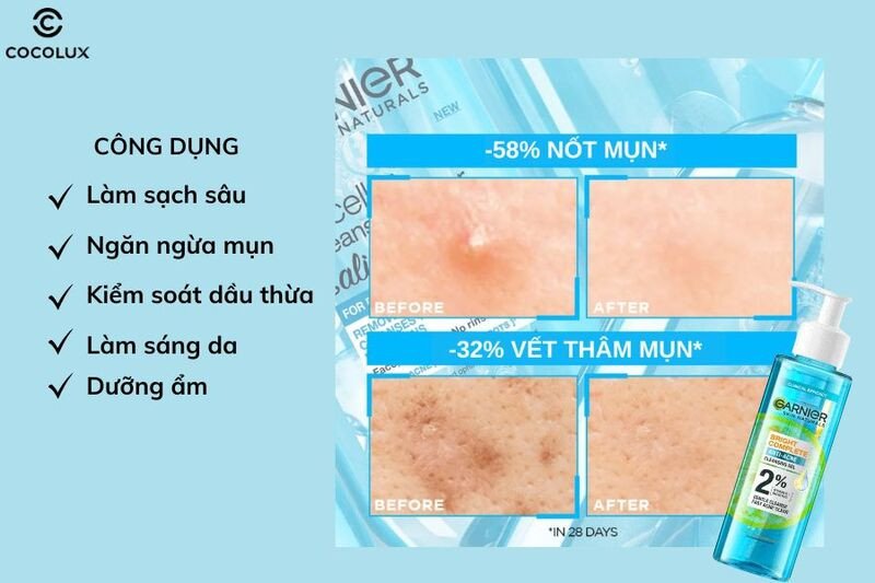 Công dụng nổi bật của Gel Rửa Mặt Garnier Bright Complete Anti-Acne