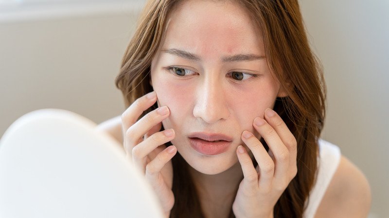 Da đang bị tổn thương dễ gây tình trạng đắp mặt nạ bị rát