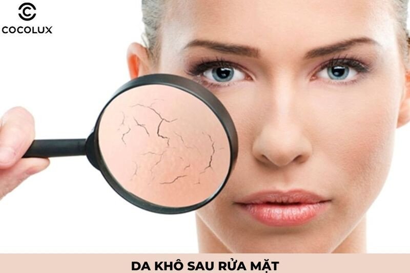 Da khô căng rát, dấu hiệu dùng sai sữa rửa mặt
