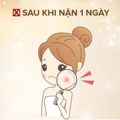 Da nhạy cảm sau khi nặn mụn
