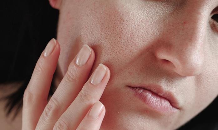 Đặc điểm da khô thiếu ẩm tự nhiên cần sữa rửa mặt phù hợp