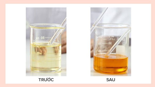 Dung dịch peel da trong lọ, cần bảo quản cẩn thận để duy trì hiệu quả khi peel da tại nhà