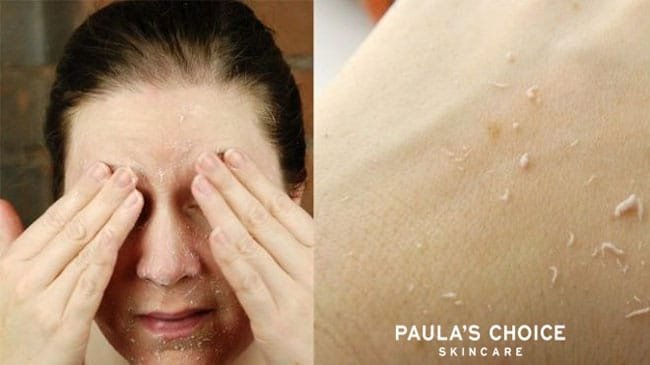Hậu quả của việc lạm dụng tẩy tế bào chết gây tổn thương da