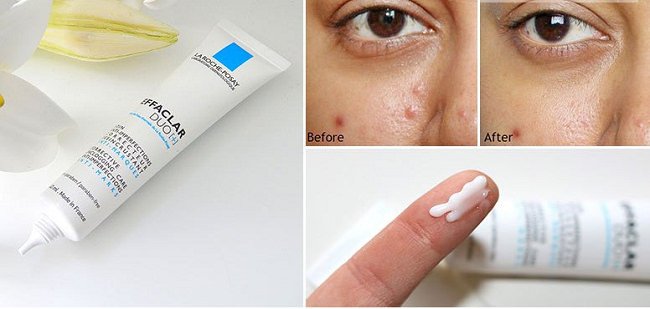 Hiệu quả của La Roche-Posay Duo+ trên da mụn trứng cá
