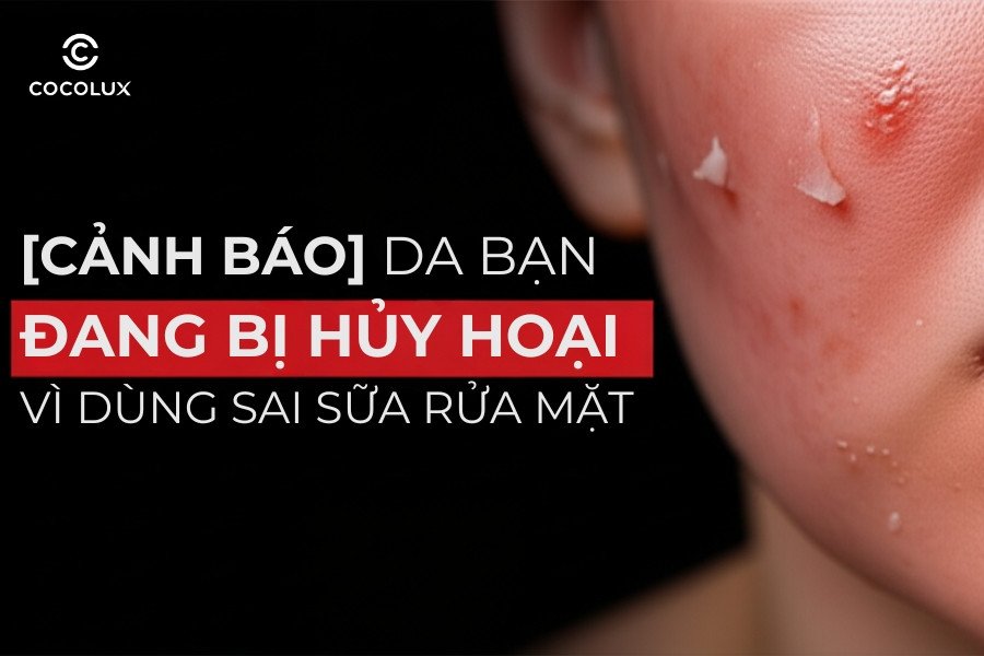 Hình ảnh cảnh báo hậu quả khi dùng sai sữa rửa mặt, da bị tổn thương và kích ứng.
