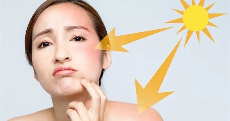 Kem chống nắng giúp hạn chế tác động của ánh nắng mặt trời