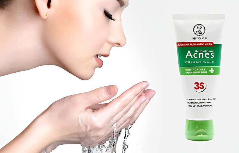 Kem rửa mặt Acnes Creamy Wash phù hợp cho da dầu mụn
