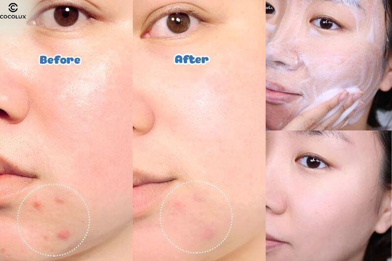 Khả năng làm sạch vượt trội của sữa rửa mặt La Roche Posay