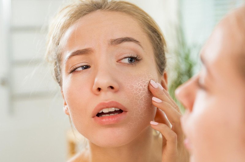 Lợi ích cấp ẩm của xịt khoáng cho làn da khô