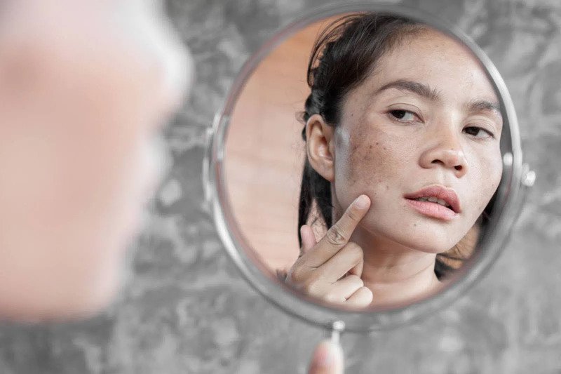 Massage mặt bằng dầu dừa giúp làm mờ thâm nám