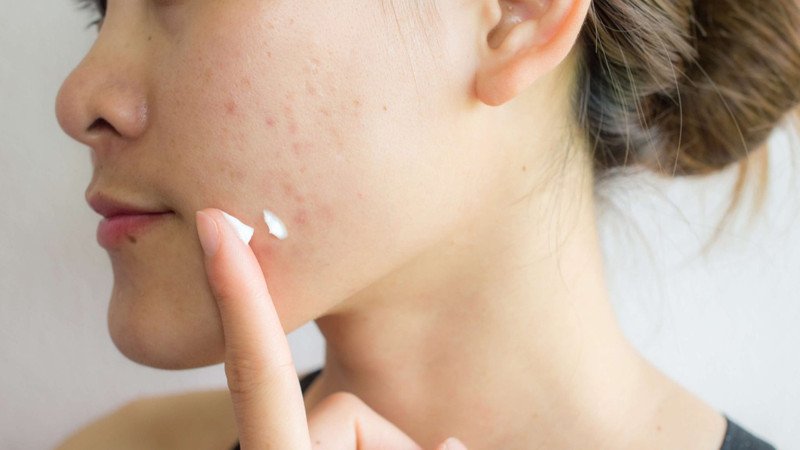 Người trẻ tuổi bắt đầu dùng Retinol