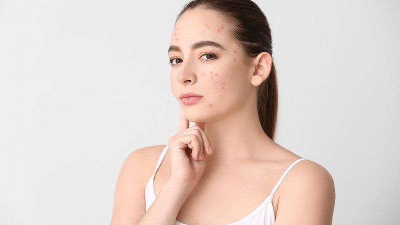 Nguyên nhân da hỗn hợp thiên dầu