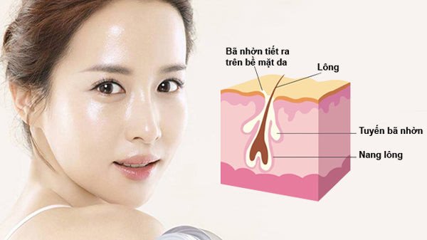 nguyên nhân hình thành sợi bã nhờn do tuyến dầu hoạt động quá mức