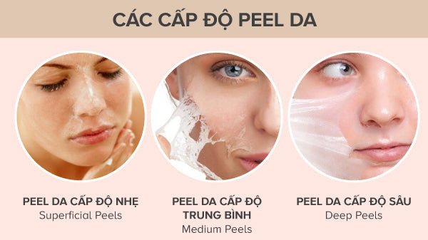 Phân biệt các cấp độ peel da hóa học nông, trung bình, sâu