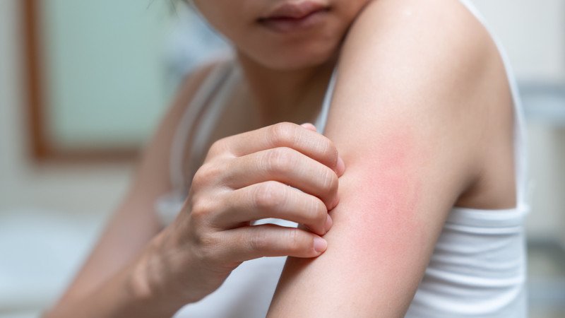 Quản lý căng thẳng giúp giảm ngứa cho người bị viêm gan B