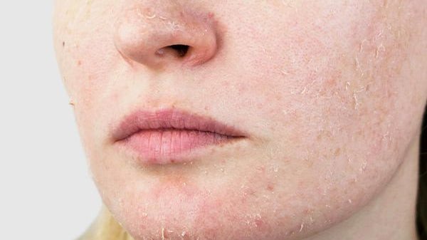 Quy trình các bước cách dùng gel tẩy tế bào chết da mặt an toàn đúng chuẩn