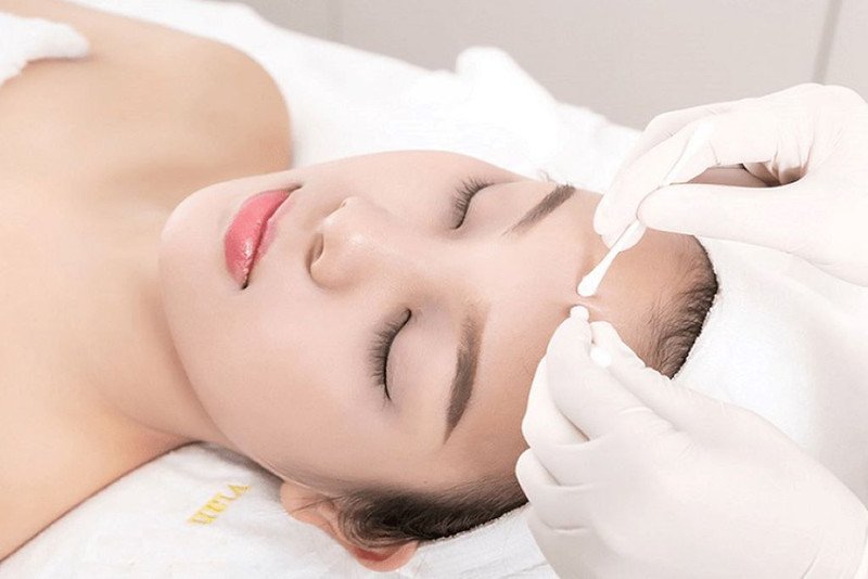 Quy trình nặn mụn chuẩn y khoa giúp hạn chế tổn thương da