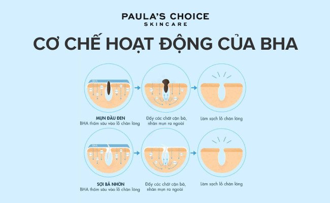 Sơ đồ mô tả cơ chế hoạt động của BHA thẩm thấu sâu vào lỗ chân lông