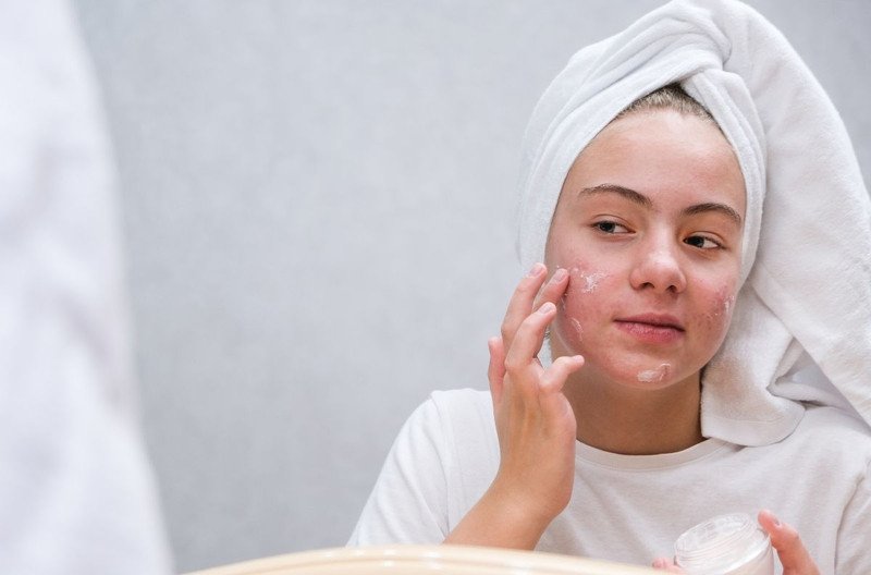 Sự kết hợp đa dạng các sản phẩm điều trị giúp làn da mụn cải thiện nhanh chóng