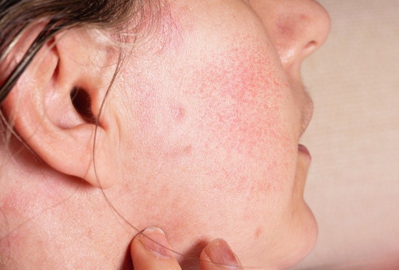 Sữa rửa mặt có độ pH dịu nhẹ dành cho da nhạy cảm dễ kích ứng