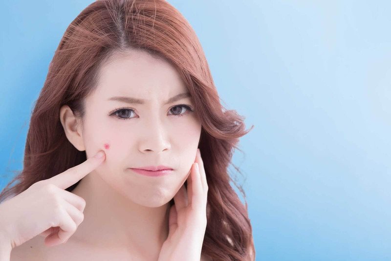 Sữa rửa mặt Perfect Whip Xanh hỗ trợ làm sạch sâu, giúp cải thiện tình trạng mụn