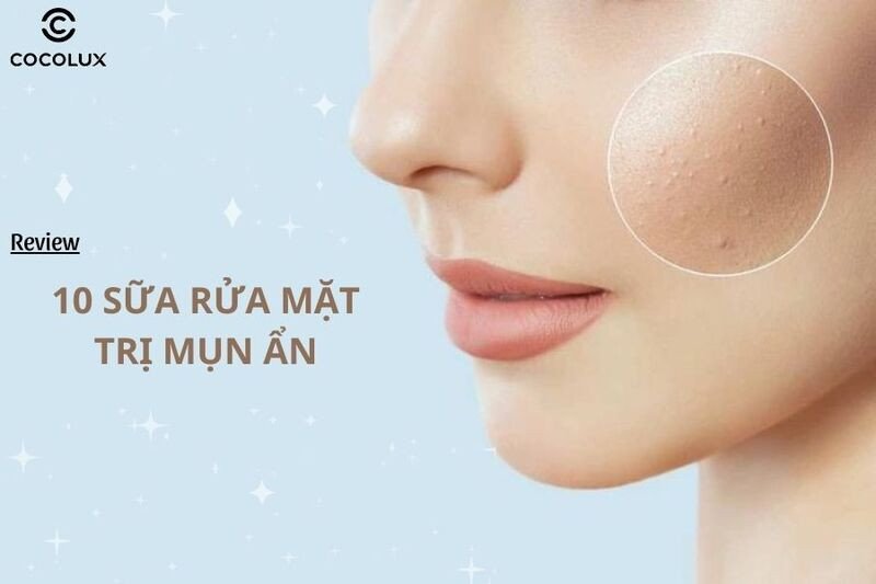 Sữa rửa mặt trị mụn ẩn giúp làm sạch da