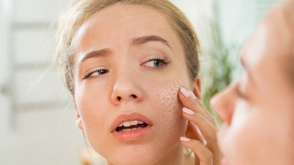Tầm quan trọng của việc lựa chọn sữa rửa mặt chuyên biệt cho da khô