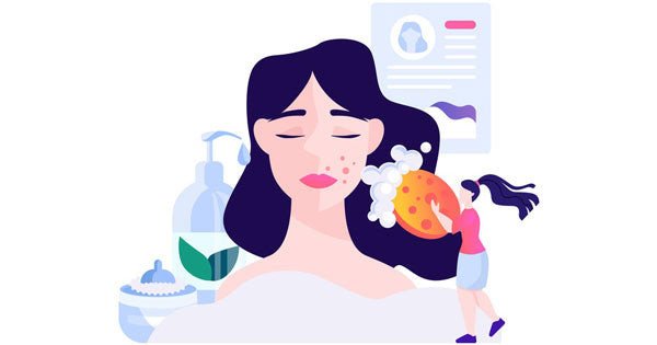 Thiếu niên bị mụn trứng cá ở tuổi dậy thì