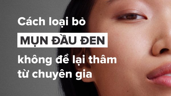 Tìm hiểu nguyên nhân và cách loại bỏ mụn đầu đen hiệu quả