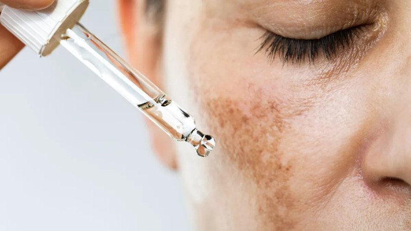 Tinh chất Retinol cải thiện cấu trúc da