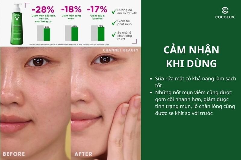 Trải nghiệm thực tế của người dùng về Gel rửa mặt Vichy