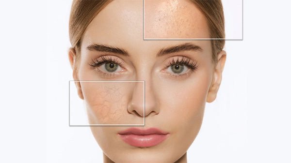 ưu và nhược điểm da hỗn hợp, ưu điểm và nhược điểm của da hỗn hợp