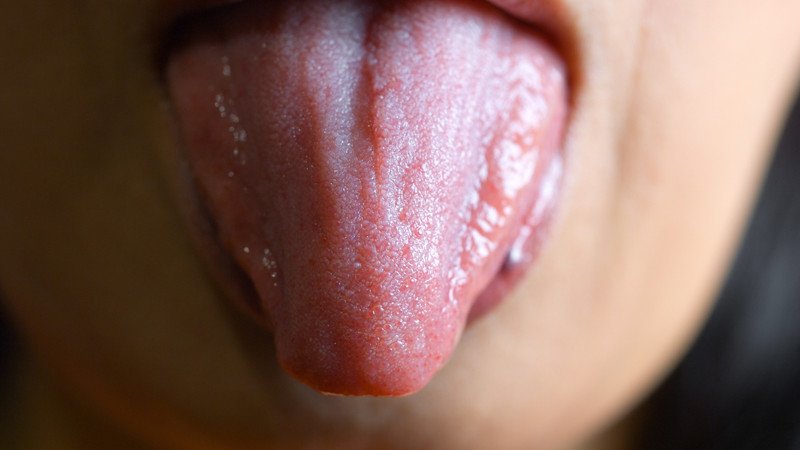 Vệ sinh răng miệng đúng cách để hỗ trợ điều trị nấm lưỡi